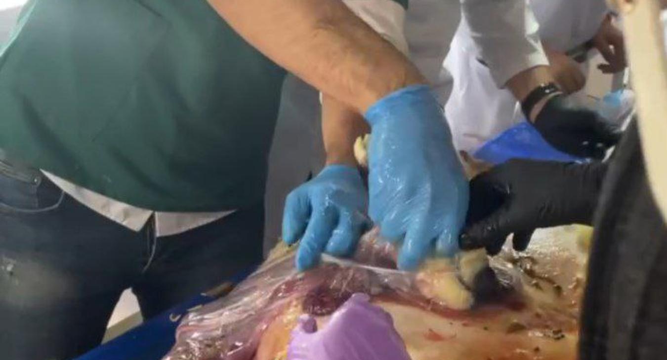The Department of Surgery and Theriogenology Receives a Case of Dystocia (Difficult Labor).
